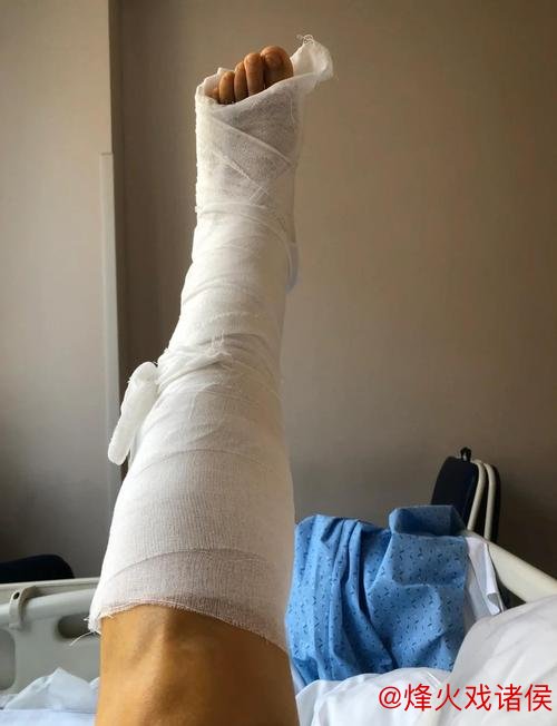 林孝天重创！右踝韧带撕裂并伴右侧腓骨骨折